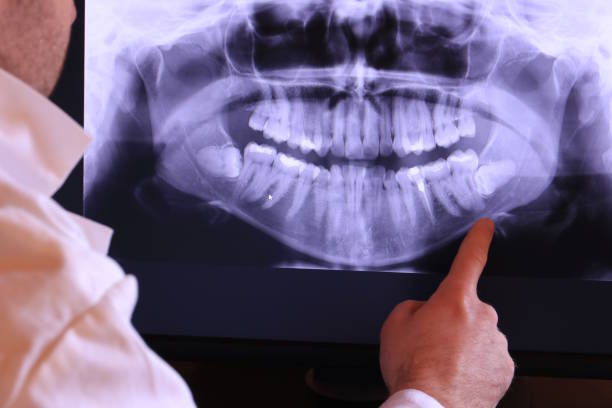 Best Emergency Dentist for Special Needs Patients in Dimondale, MI