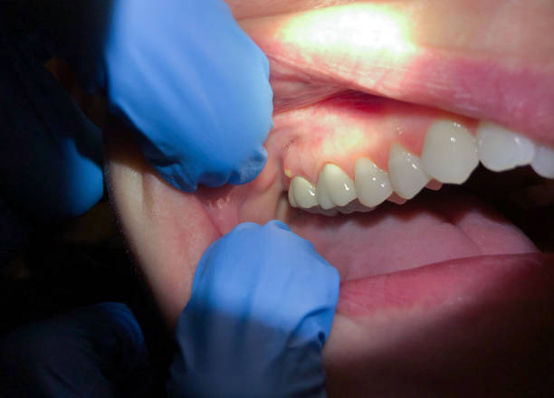 Best Emergency Dental Services for Seniors in Dimondale, MI