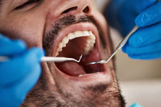 Best Broken or Cracked Tooth Emergency Dentist in Dimondale, MI