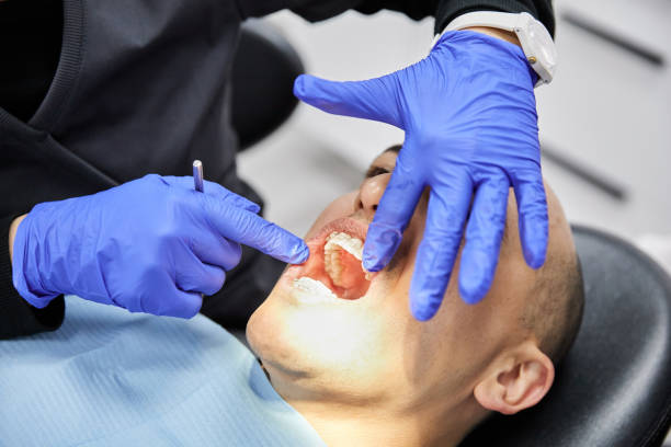 Best Emergency Root Canal Treatment in Dimondale, MI
