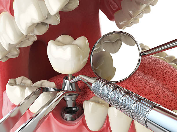 Best Orthodontic Emergency Dentist in Dimondale, MI